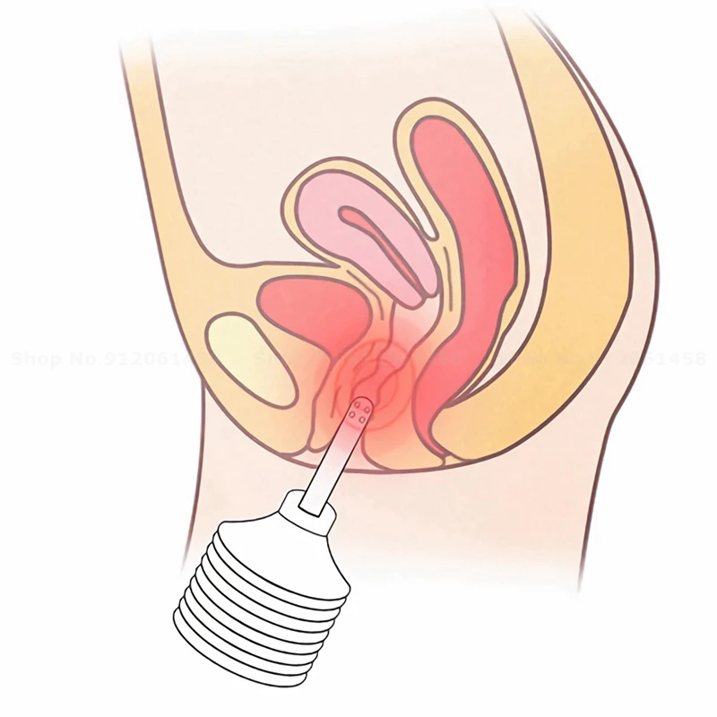 Nettoyeur de lavement 180ML, jouets Sexy pour hommes, fille complète, Plug Anal, outils Sexy, jouets adultes, jouets sexuels pour femmes