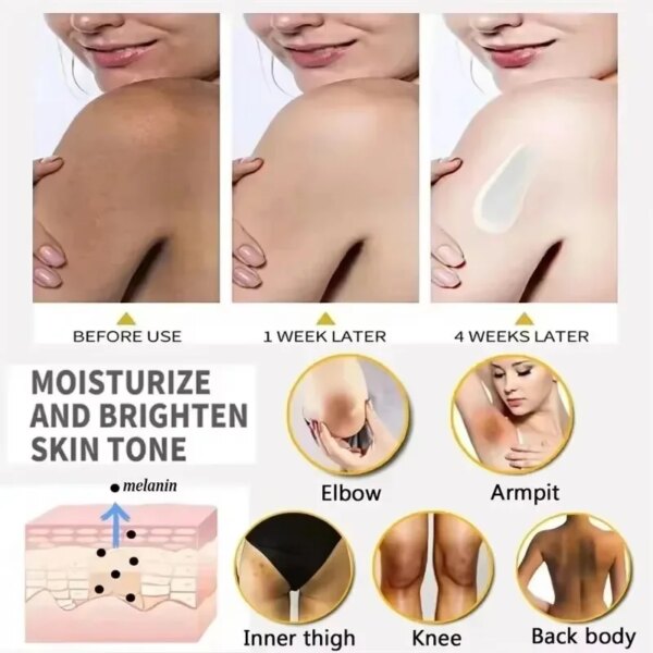 Crème blanchissante pour le corps, parties intimes, sérum blanchissant pour les aisselles, blanchit les fesses et les genoux, éclaircit l'intérieur des cuisses, intime, foncé, élimine la mélanine – Image 5